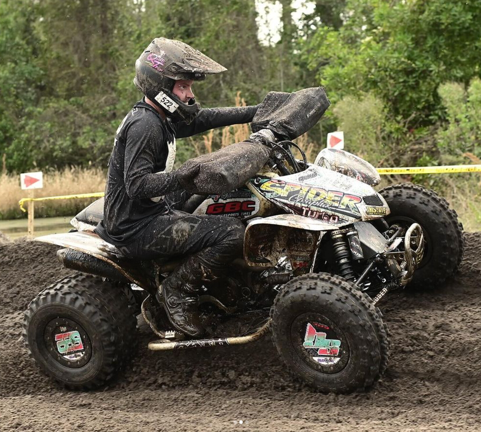 After being diagnosed with cancer in his left forearem at a young age, Adam has pretty much lived his whole life as an amputee.